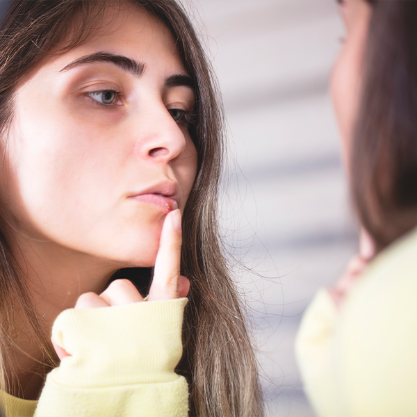 Afbeelding van een vrouw die in de spiegel naar haar koortsblaasje kijkt